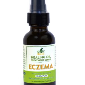 ECZEMA OIL-1 FL OZ (30 mL)