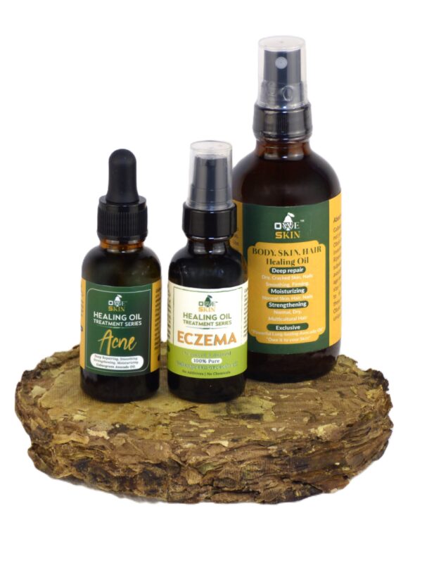 ECZEMA OIL-1 FL OZ (30 mL) - Image 4